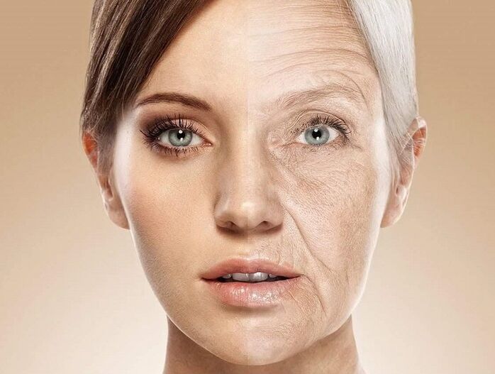 piel facial antes y después del rejuvenecimiento con láser